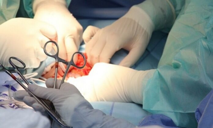 Ligamentotomy – penis enlargement surgery