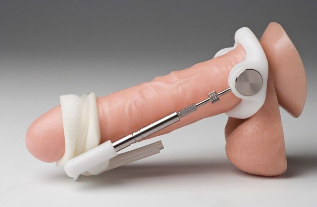 Expansion to increase the thickness of the penis